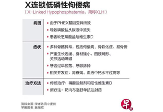 医界针对亚太区罕见佝偻病 推出管理与治疗指南